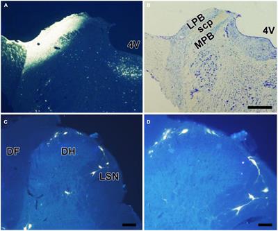 Morphological investigations of endomorphin-2 and spinoparabrachial projection neurons in the spinal dorsal horn of the rat